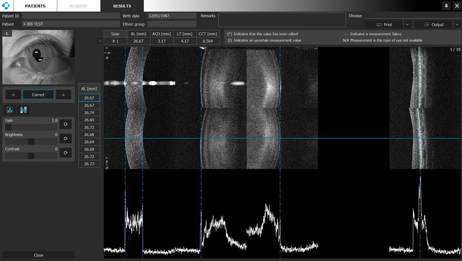 Revo 80 OCT Scanning
