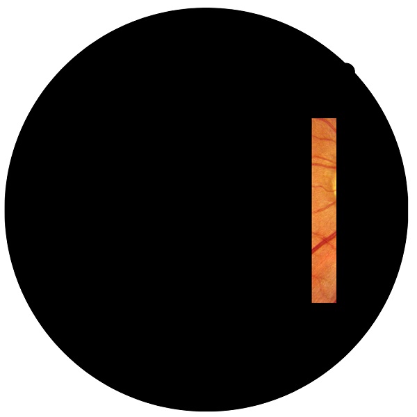 Healthy-Retina-Imaging