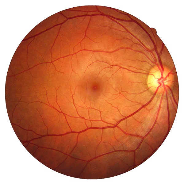 Healthy-Retina